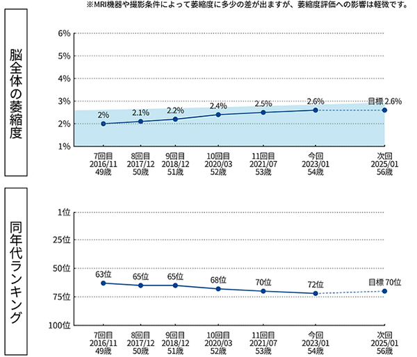 脳健康評価プログラム「エムビジョン・ヘルス」で分かること